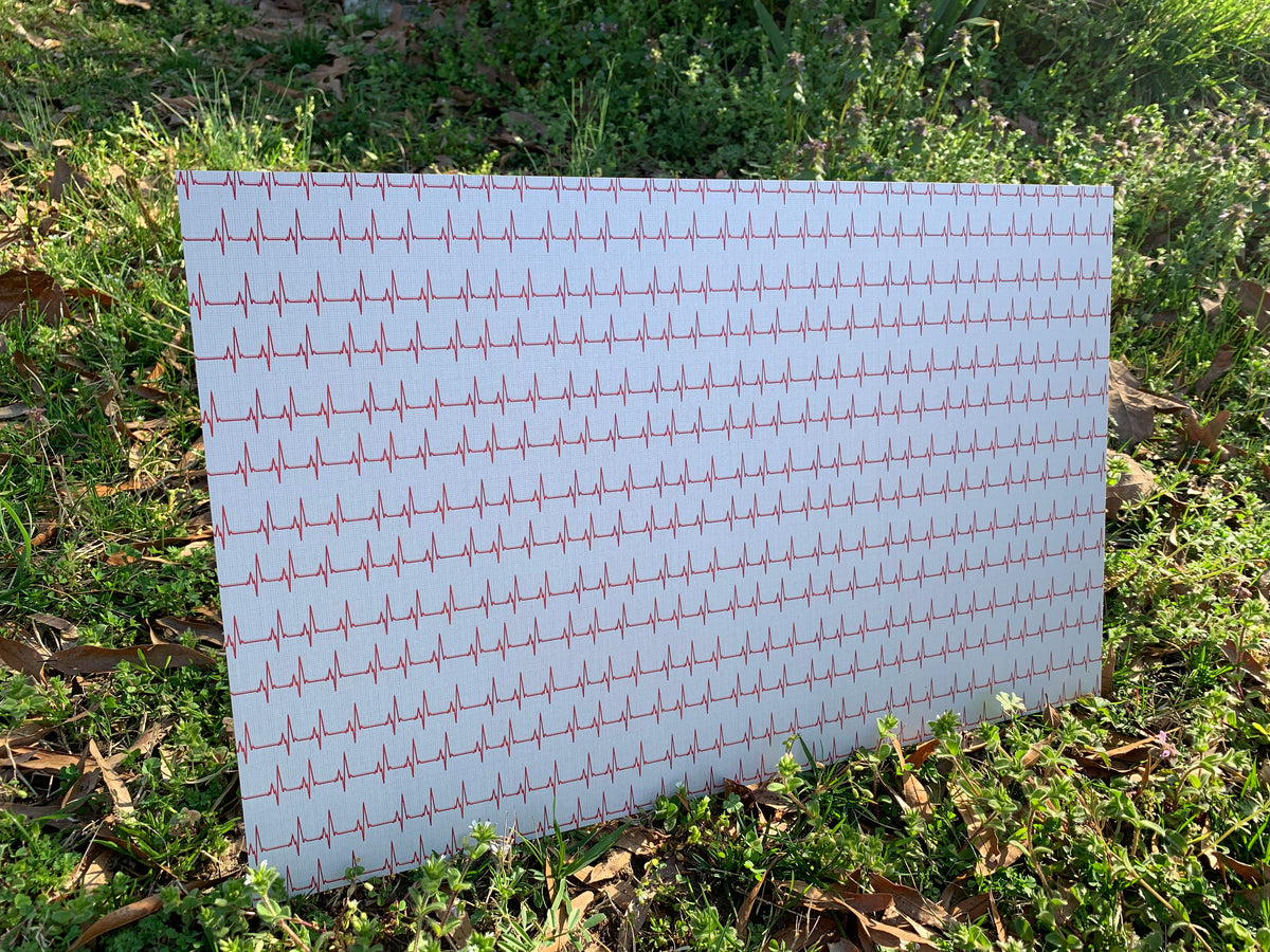 PatternPly® Full Coverage EKG product photo 3